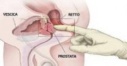 La prostata è una parte fondamentale dell’apparato genitale maschile che col tempo può ingrossarsi e dar luogo a problemi, tra cui l’incontinenza. È possibile alleviare tali problemi con il massaggio prostatico. Scopri di cosa si tratta e come funziona.
