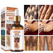 Dark Knuckle Whitening Serum In Washington
City in Kansas Call +27710732372 Get Rid Of Tattoos And Dark Spots In Sneltvedt
Village in Norway
