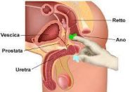 Il massaggio prostatico serve principalmente a drenare i liquidi in eccesso e i residui accumulati nella prostata, utile nel trattamento di prostatiti croniche e per alleviare sintomi dell'ipertrofia prostatica benigna (IPB), come difficoltà urinarie