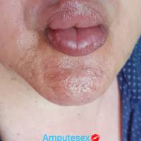 *Super Esclusivo! Amputato Real Sex 👅