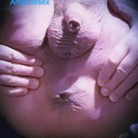 Amputesex!