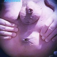 AAA Amputesex!