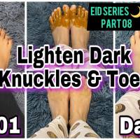 Dark Knuckle Whitening Serum In Washington
City in Kansas Call +27710732372 Get Rid Of Tattoos And Dark Spots In Sneltvedt
Village in Norway
