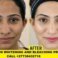 Permanent Skin Lightening Skin Whitening Products +27738432716

Permanent Skin Lightening Skin Whitening Pills Injection IN Pretoria Johannesburg Midr
