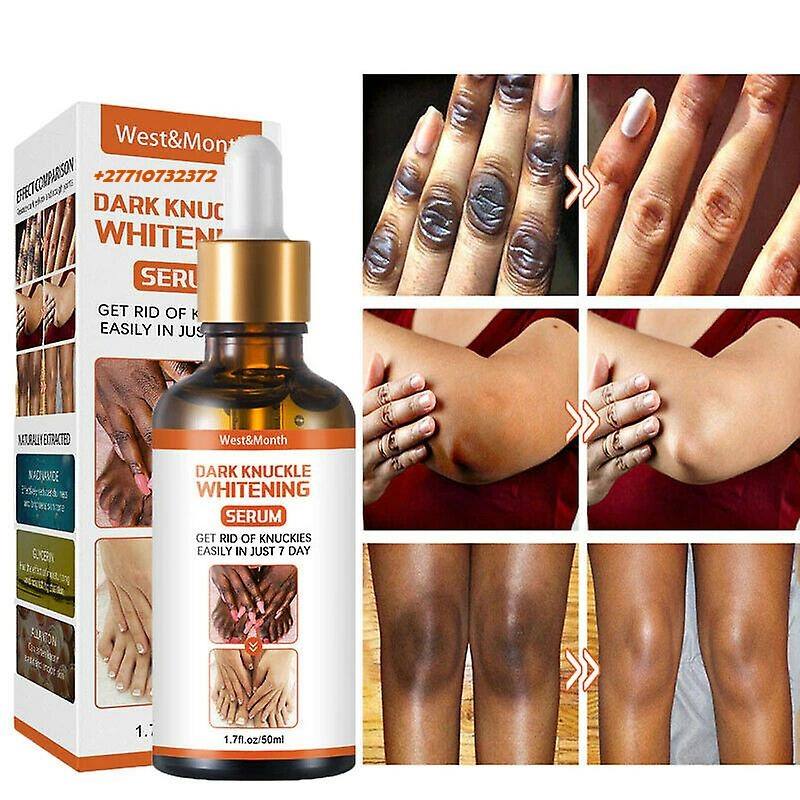 Dark Knuckle Whitening Serum In Washington
City in Kansas Call +27710732372 Get Rid Of Tattoos And Dark Spots In Sneltvedt
Village in Norway
