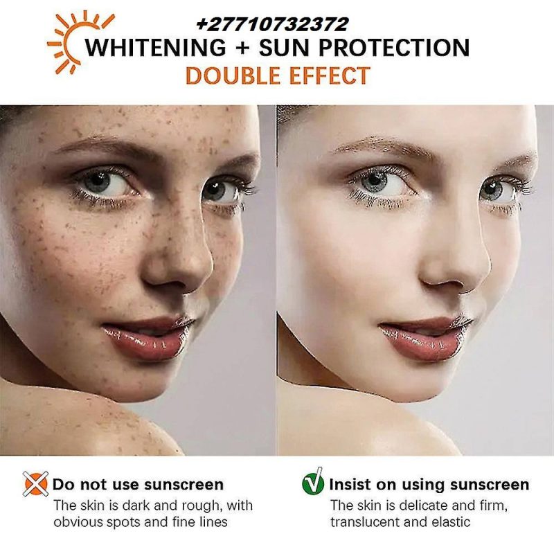 Scars And Stretch Marks Removal Cream In Hanover
City in Kansas Call +27710732372 Pimple Treatment In Miland
Village in Norway
