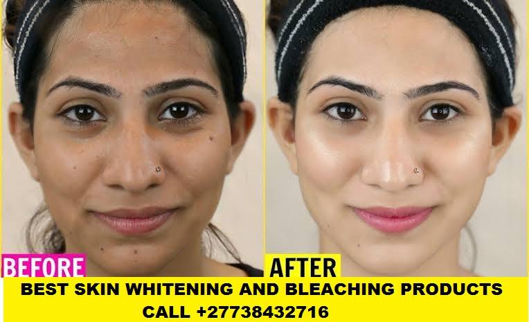 Permanent Skin Lightening Skin Whitening Products +27738432716

Permanent Skin Lightening Skin Whitening Pills Injection IN Pretoria Johannesburg 