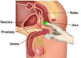 Il massaggio prostatico serve principalmente a drenare i liquidi in eccesso e i residui accumulati nella prostata, utile nel trattamento di prostatiti croniche e per alleviare sintomi dell'ipertrofia prostatica benigna (IPB), come difficoltà urinarie