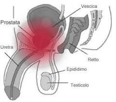 BENEFICI DELLA PROSTATA
favorisce un buon flusso sanguigno a livello della prostata e del perineo che aiuta a prevenire e contrastare le infezioni del tratto urinario; migliora il controllo della minzione poiché riduce i problemi derivanti dall'ingross