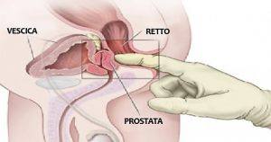 La prostata è una parte fondamentale dell’apparato genitale maschile che col tempo può ingrossarsi e dar luogo a problemi, tra cui l’incontinenza. È possibile alleviare tali problemi con il massaggio prostatico. Scopri di cosa si tratta e come funziona.
